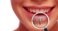 Лечение зубов во время месячных